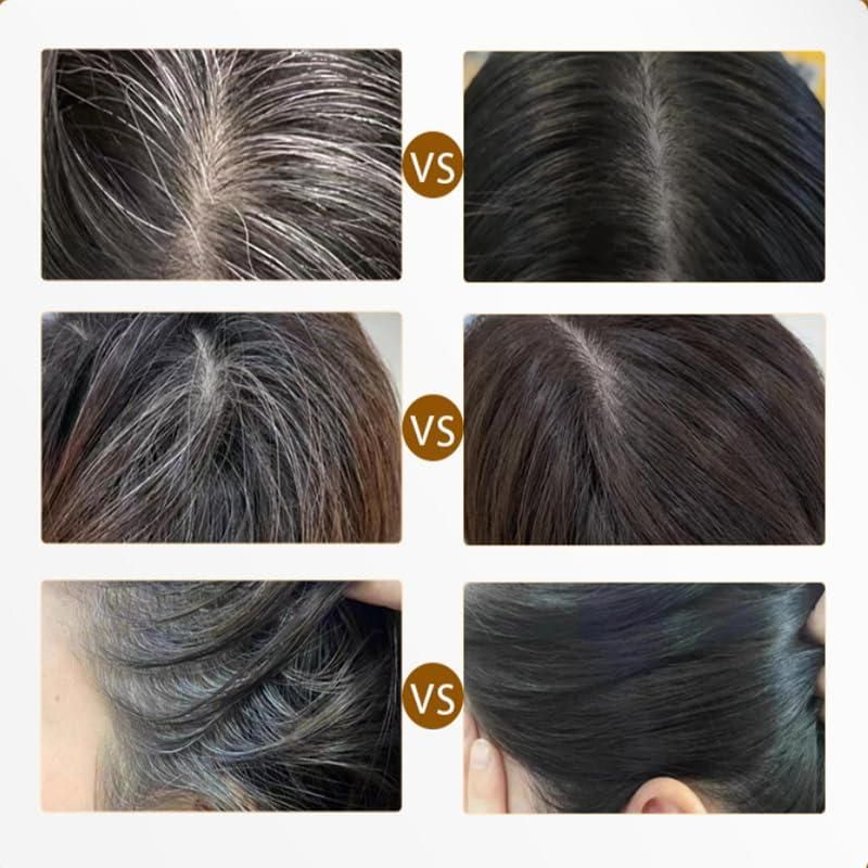 Covering White Hair Is Simple Convenient…