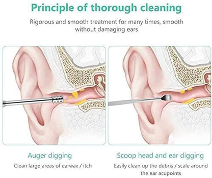 6 Ear Wax Removal Smooth Stainless Steel…
